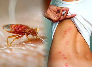 adult bed bug and examples of bed bug bits